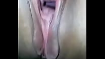 Vagina abierta